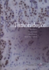 Tumori dojke Tumori dojke