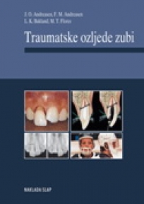 Traumatske ozljede zubi