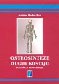 Osteosinteze dugih kostiju