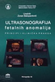 Ultrasonografija fetalnih anomalija