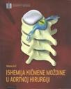Ishemija kičmene moždine u aortnoj hirurgiji Ishemija kičmene moždine u aortnoj hirurgiji