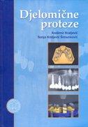 Djelomične proteze