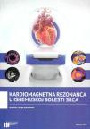 Kardiomagnetna rezonanca u ishemijskoj bolesti srca Kardiomagnetna rezonanca u ishemijskoj bolesti srca