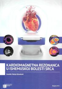 Kardiomagnetna rezonanca u ishemijskoj bolesti srca