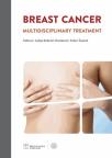 Breast cancer - multidisciplinary treatment