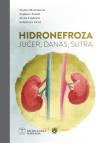Hidronefroza jučer, danas, sutra