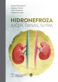 Hidronefroza jučer, danas, sutra